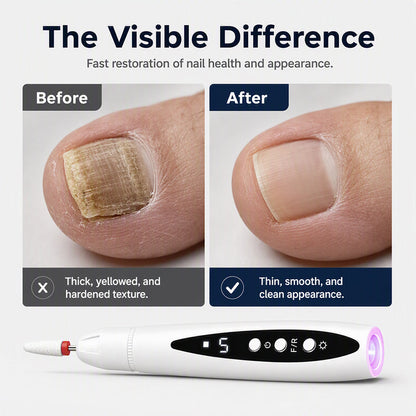 2-in-1 elektrische Nagelfräse mit UV-Gellampe – tragbares Maniküre- und Pediküre-Set